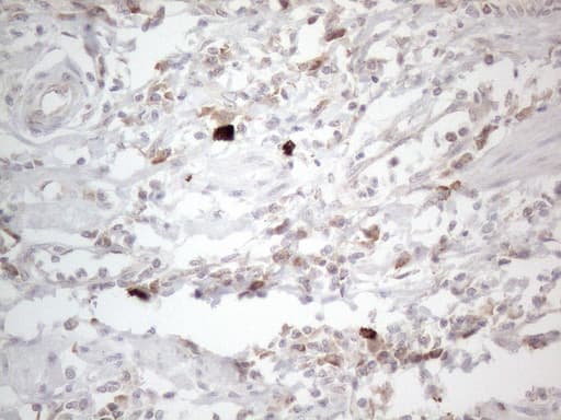 Monoclonal Mouse anti-Human PD-L2 / PDCD1LG2 / CD273 Antibody (clone OTI5E5, Carrier-free, IHC, WB)