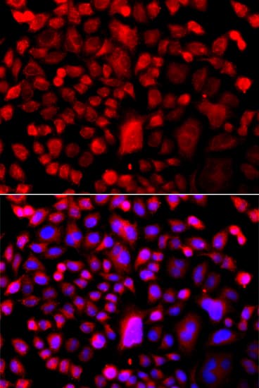TP53BP2 / ASPP2 Antibody