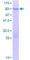 Human KRT83 / Keratin 83 / KRTHB3 Protein (Recombinant GST)