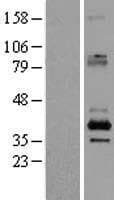 SFXN2 Protein (Over-Expression Lysate Myc-DDK (Flag))
