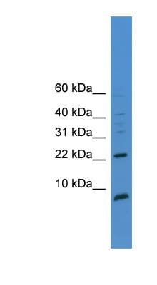 Polyclonal Rabbit anti-Human PSCA Antibody (aa51-100, WB)