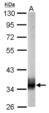 SUCLG1 / GALPHA Antibody (aa1-346)