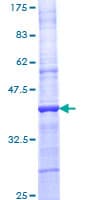Human IL3RA / CD123 Protein (Recombinant GST, N-terminus)