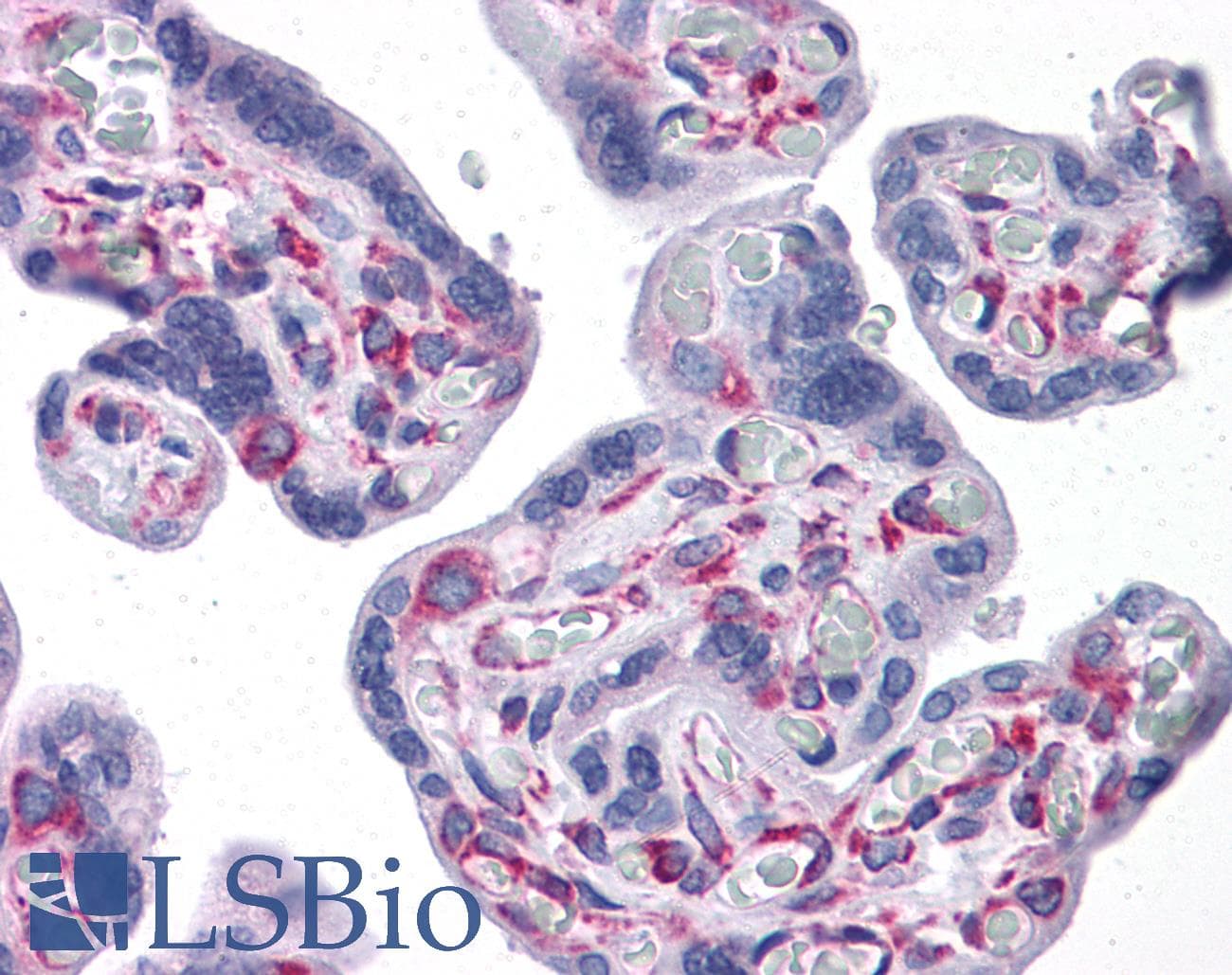 IHC-plus™ GNPDA1 Antibody