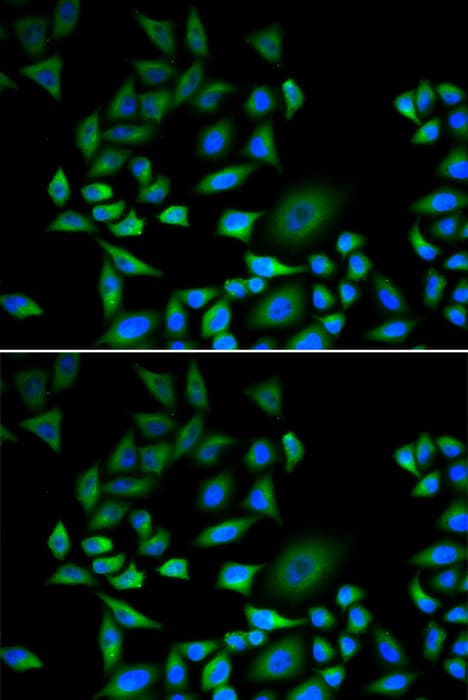 p16INK4a / CDKN2A Antibody