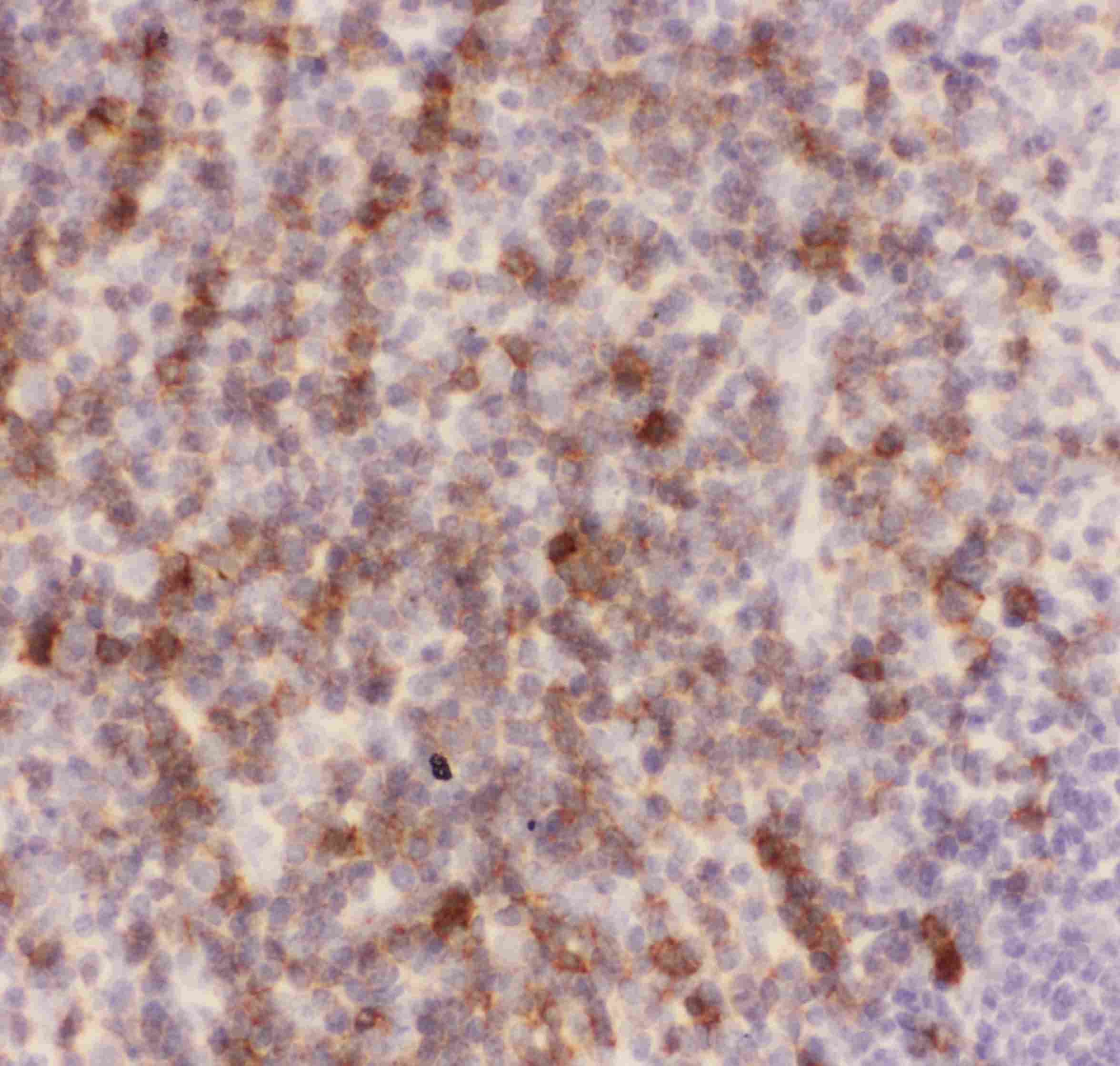 Polyclonal Rabbit anti-Human SPN / CD43 Antibody (aa272-400, IHC, WB)