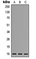 Polyclonal Rabbit anti-Human MED31 Antibody (N-Terminus, WB)