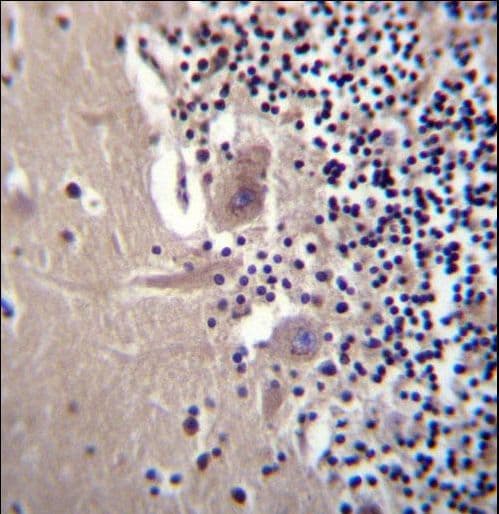 CRYBA1 Antibody (aa104-133)
