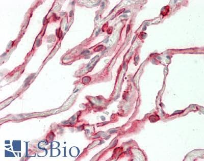 IHC-plus™ CXCR4 Antibody (C-Terminus)