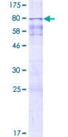 Human SPZ1 Protein (Recombinant GST)