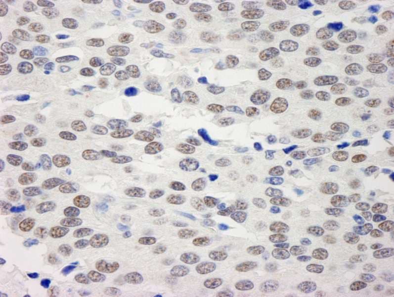 KDM1A / LSD1 Antibody (aa50-100)
