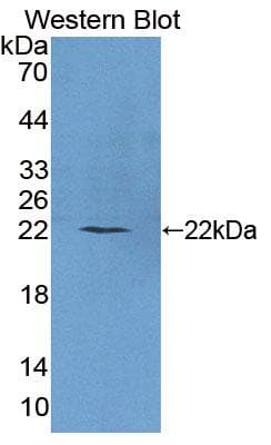 PLCB1 / Phospholipase C Beta 1 Antibody (aa316-476)
