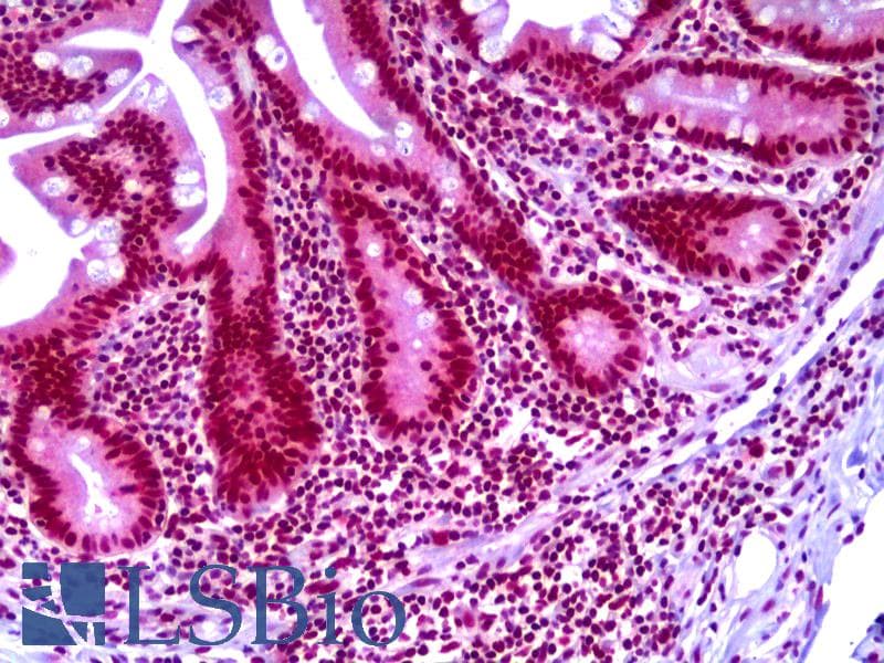 IHC-plus™ TARBP2 / TRBP2 Antibody (clone 2G10)