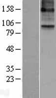 ALOX15B / 15-LOX-2 Protein (Over-Expression Lysate Myc-DDK (Flag))