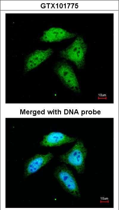 CTBP1 / CTBP Antibody (aa194-379)