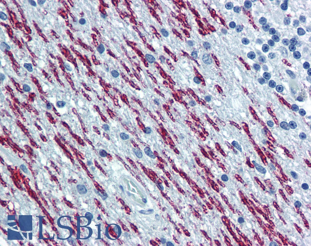 IHC-plus™ Spastin Antibody (clone 2F5)