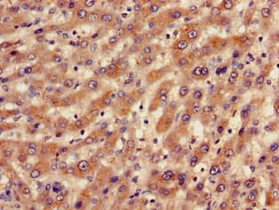 BBS10 Antibody