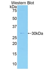 MYO1G / HA2 Antibody (aa769-1016)