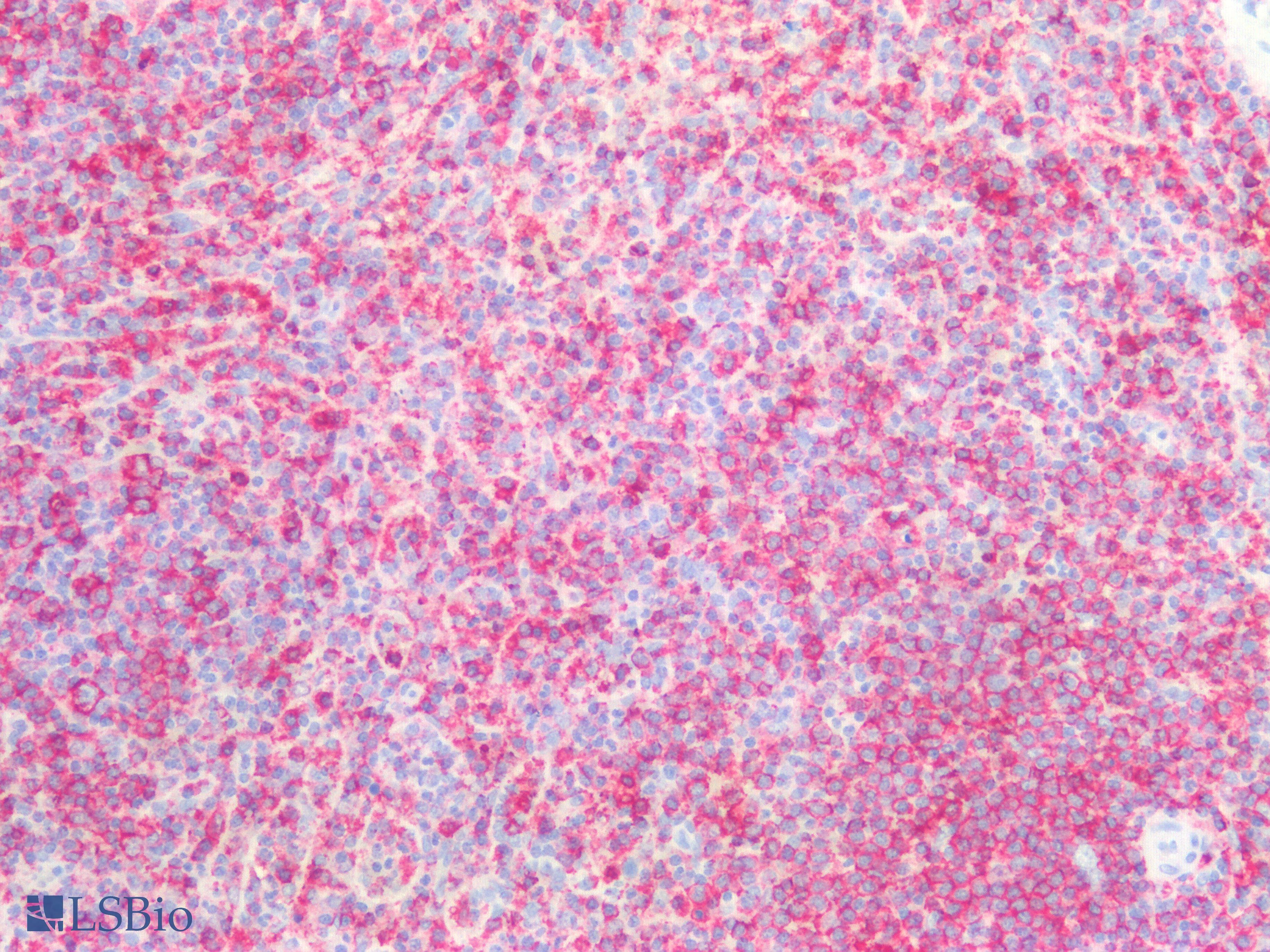 IHC-plus™ CD45R Antibody (Concentrated)