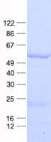Human HSF4 Protein (Recombinant His, N-Terminal)