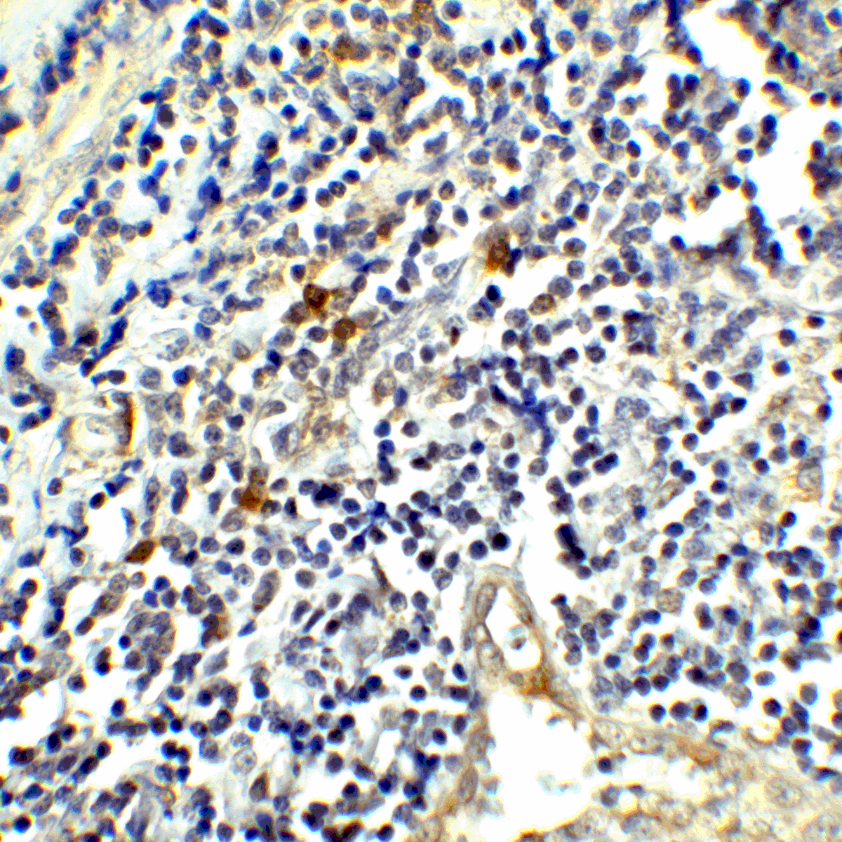 CTLA4 / CD152 Antibody (clone 1E6)