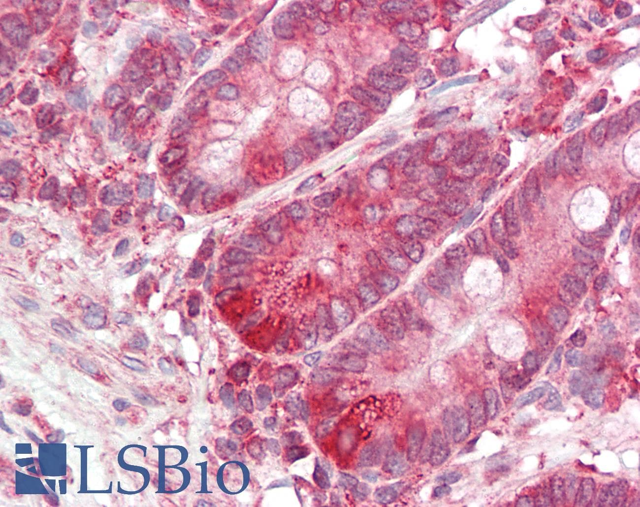 BCAP31 / BAP31 Antibody (C-Terminus)