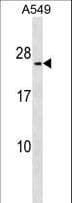 Polyclonal Rabbit anti-Human METTL7B Antibody (aa37-63, WB)