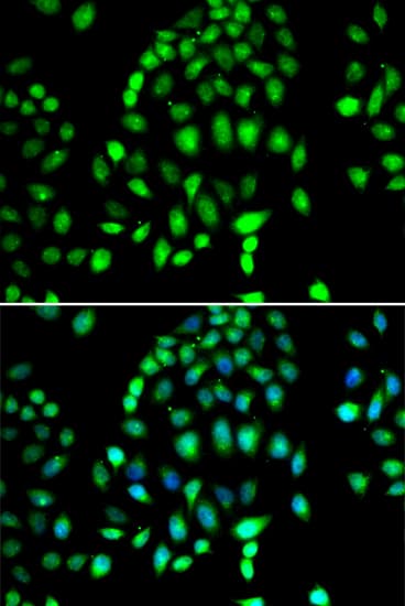PARP3 Antibody