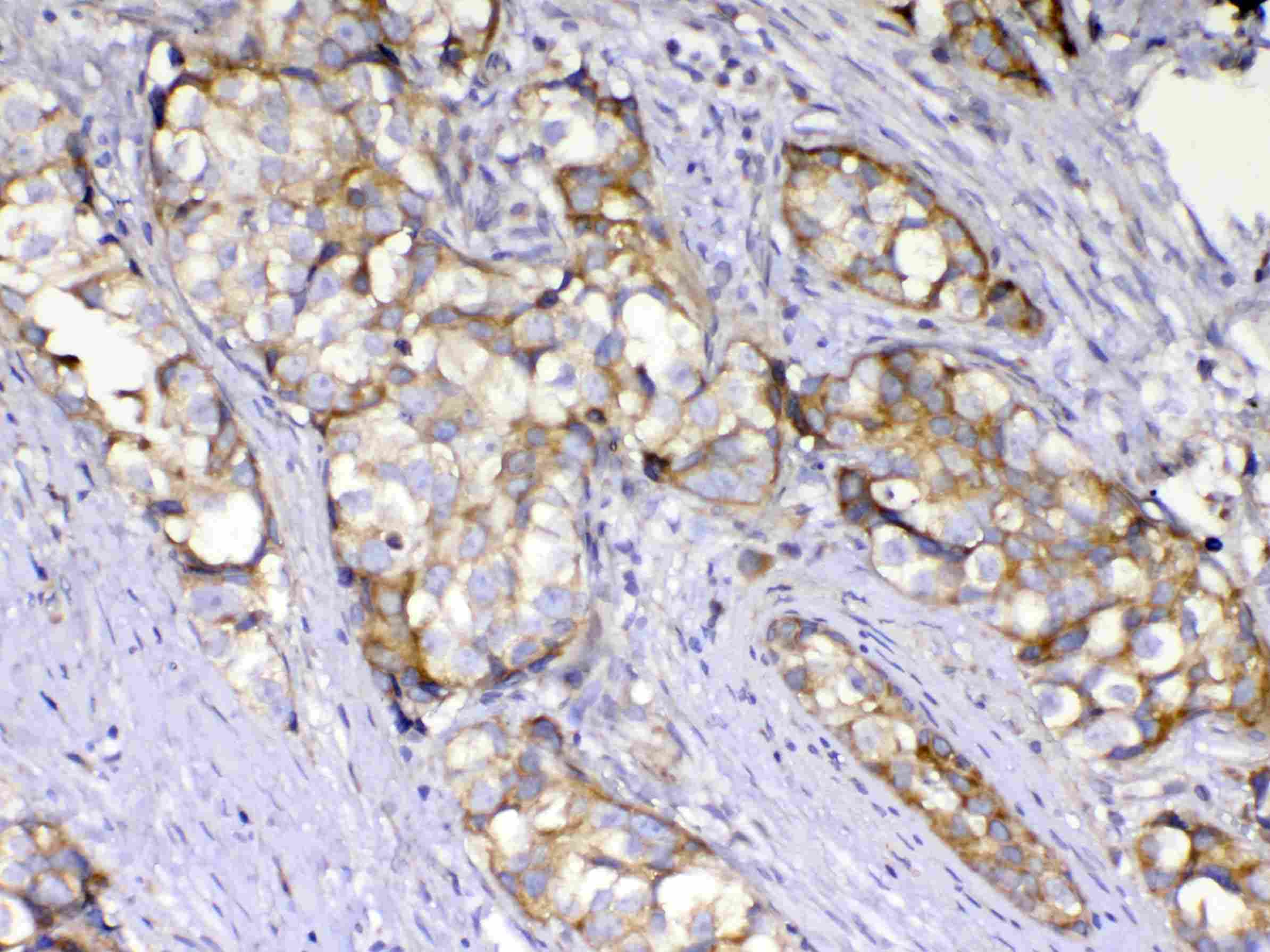 AMD / AMD1 Antibody