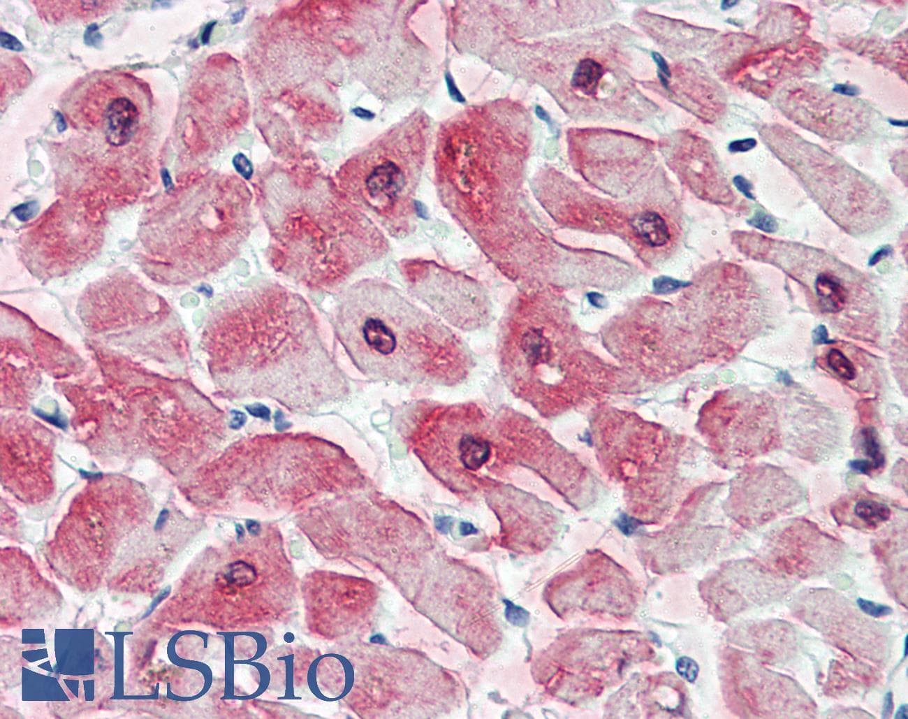 IHC-plus™ CRYAB / Alpha B Crystallin Antibody (clone 1D11C6E6)
