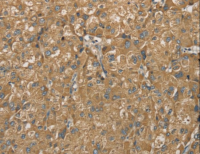 SDHB Antibody