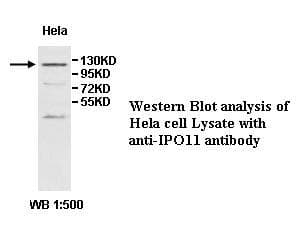 Polyclonal Rabbit anti-Human IPO11 / Importin 11 Antibody (aa37-221, IHC, WB)