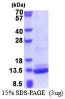 Human C3orf10 Protein (Recombinant His)