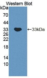 PLCB2 Antibody
