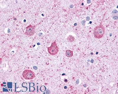 IHC-plus™ ADGRL2 / LPHN2 Antibody (C-Terminus)