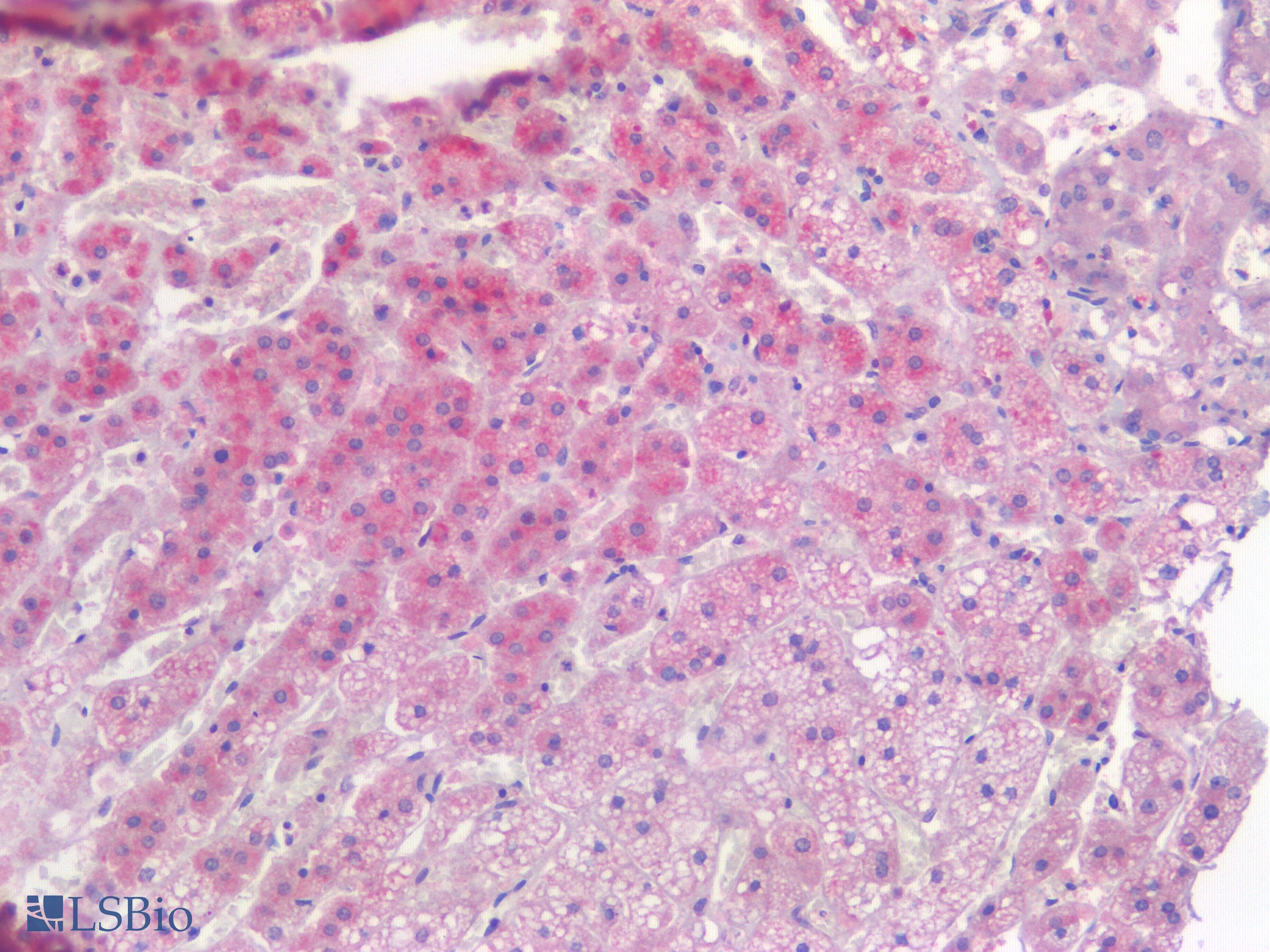 IHC-plus™ TIAM1 Antibody