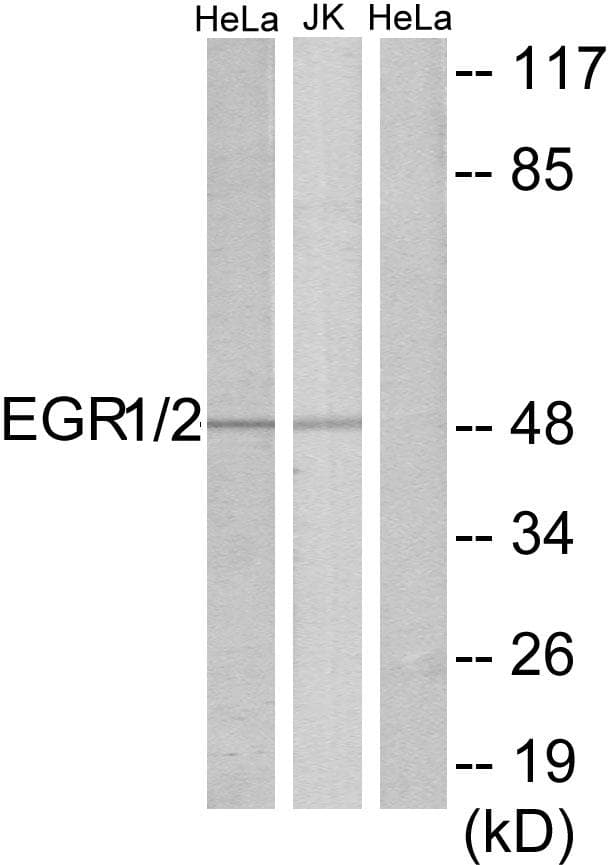EGR1 + EGR2 Antibody