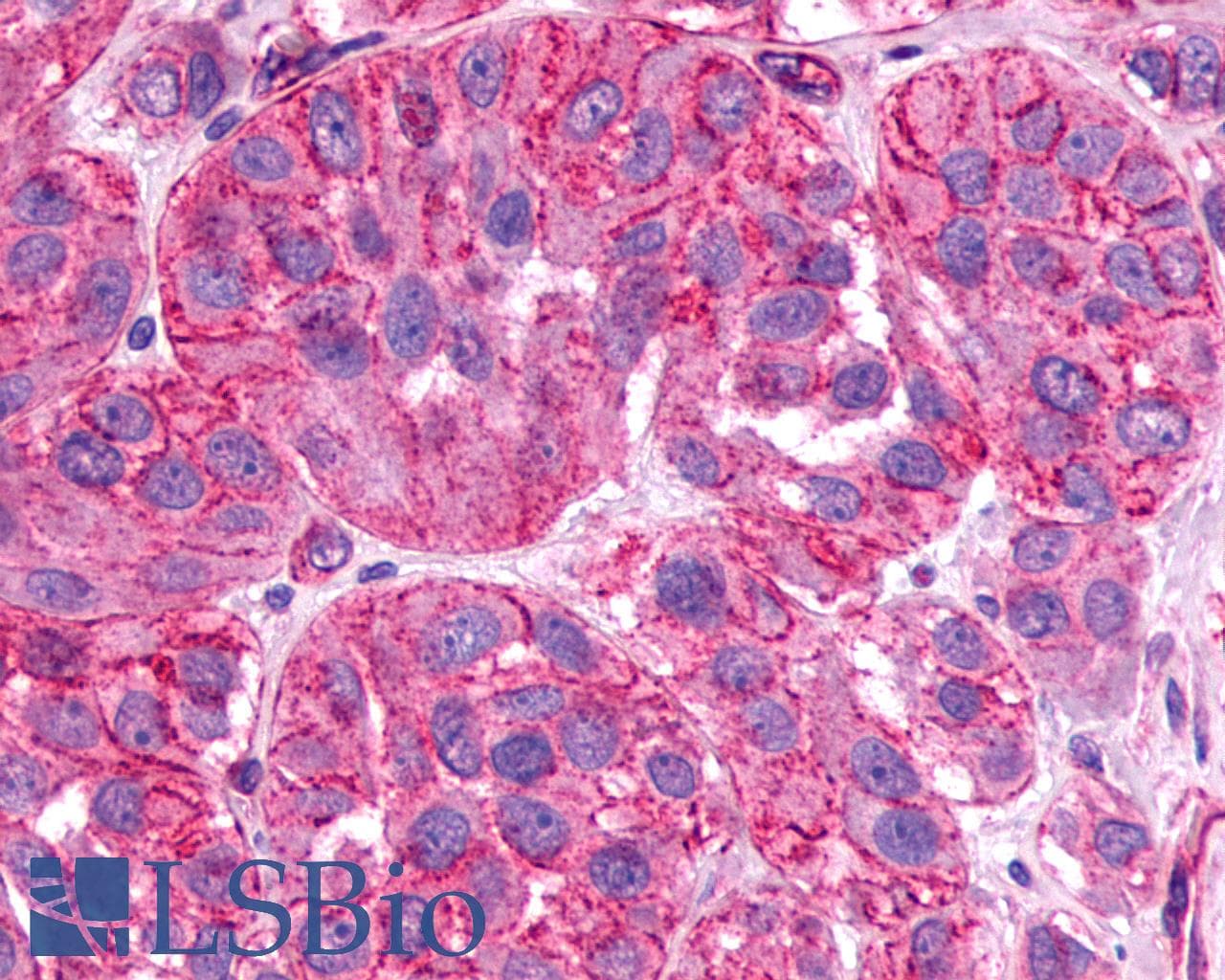 PathPlus™ Polyclonal Rabbit anti-Human SSTR1 Antibody (C-Terminus, IHC)