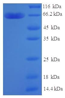 Human ZNF114 Protein (Recombinant His-SUMO)