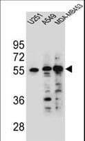 SYNC / SYNCOILIN Antibody (aa129-158)