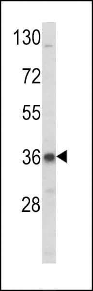 ARH / LDLRAP1 Antibody (aa11-42)