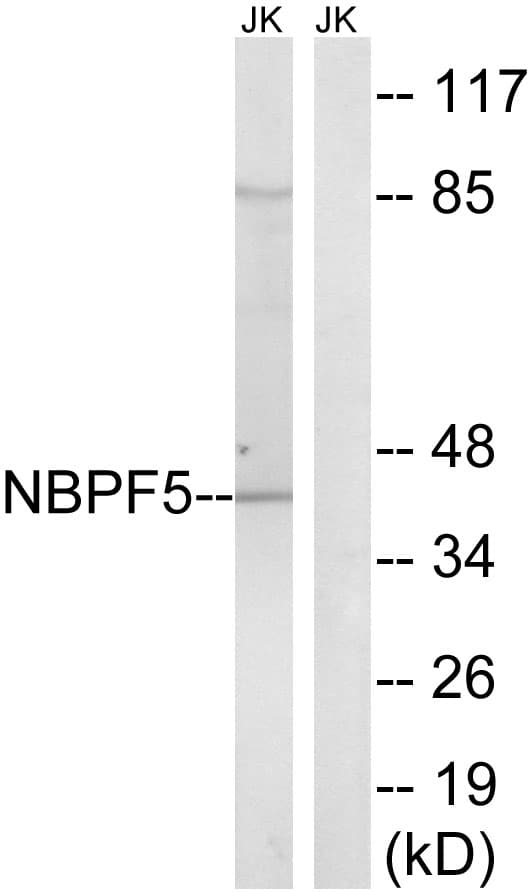 NBPF5P Antibody