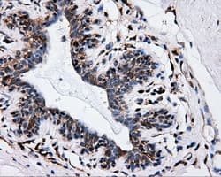 IFT57 / HIPPI Antibody (clone OTI4F6)