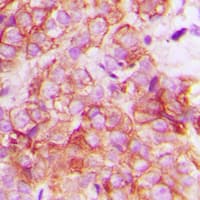 Polyclonal Rabbit anti-Human CRK Antibody (Internal, IHC, WB)