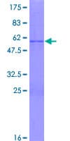 Human RHOXF1 Protein (Recombinant GST)