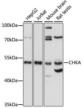 CHKA / CK / Choline Kinase Antibody