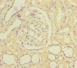 SLC6A12 / BGT-1 Antibody
