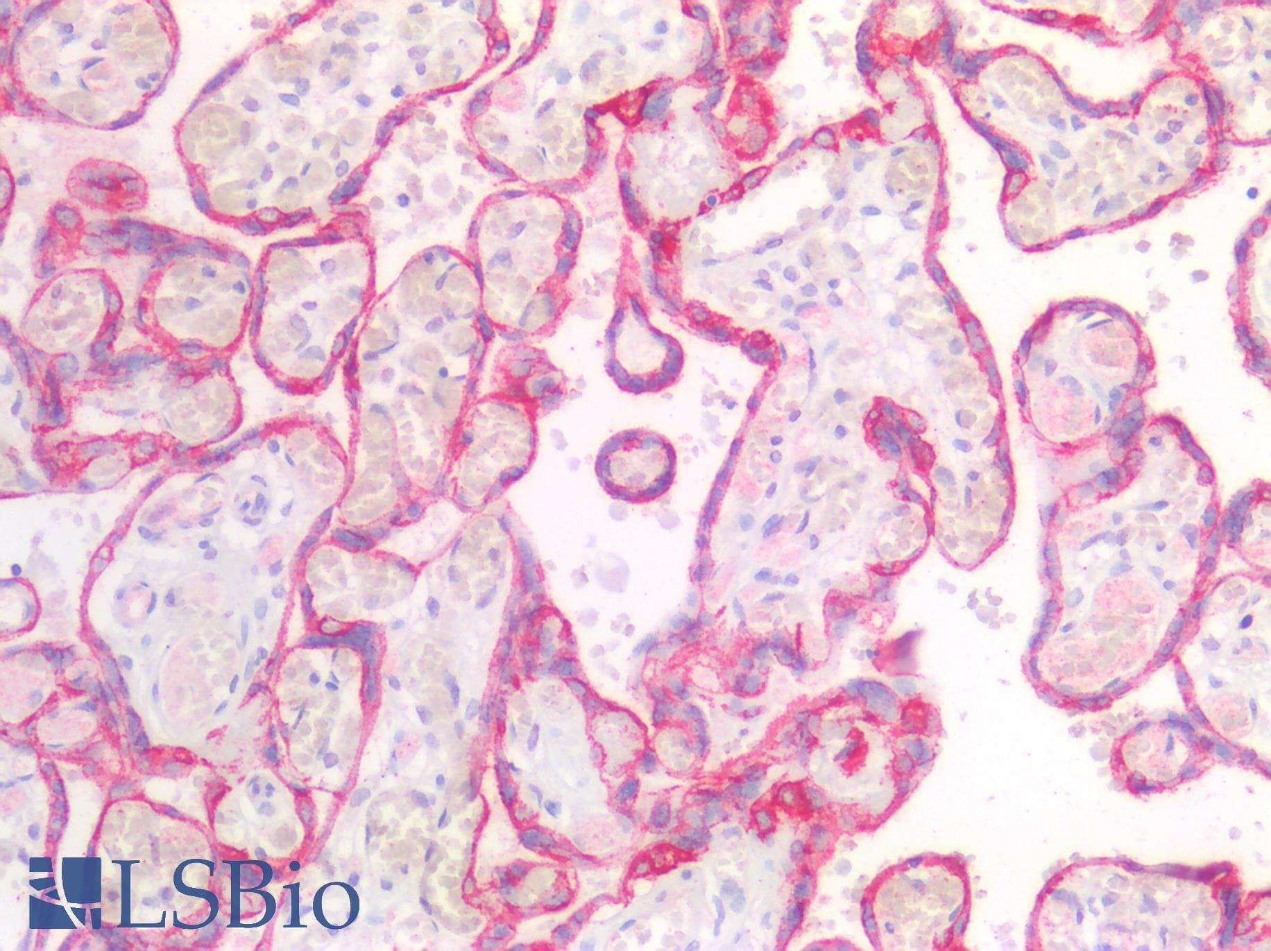 PathPlus™ KRT5 / CK5 / Cytokeratin 5 Antibody