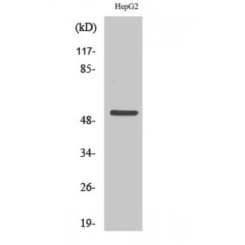 Polyclonal Rabbit anti-Human KRT7 / CK7 / Cytokeratin 7 Antibody (390-470 aa, C-terminal, IHC, IF, WB)
