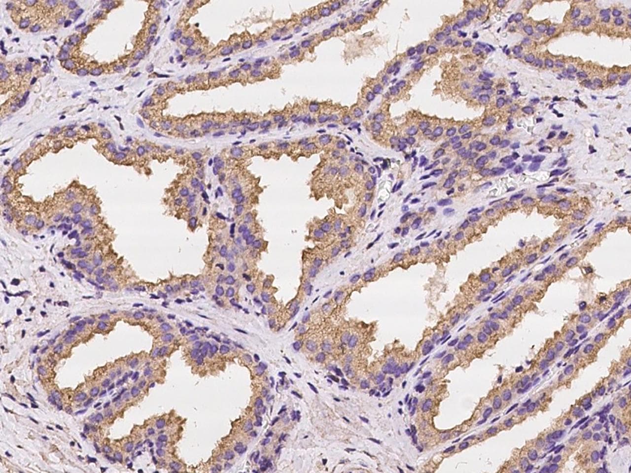 Polyclonal Rabbit anti-Human STC2 / Stanniocalcin 2 Antibody (IHC)